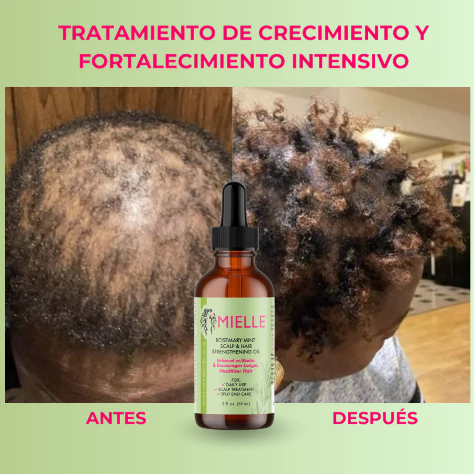 🌿 ¿La caída del cabello no se cura se trata  ? - Mielle Rosemary Mint te cura desde la Raiz